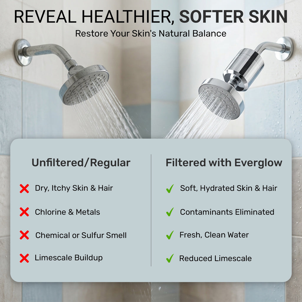 EVERGLOW High-Output Shower Filter, Reduces Chlorine, Dry Skin, Dandruff, Eczema, Heavy Metals and Vitamin C Infused for Dandruff and Softens Hard Water, 4.7”